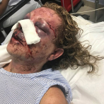 Turista denuncia fue atacada mientras vacacionaba en Punta Cana