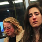 Una pareja de chicas sufre un ataque homófobo en un autobús de Londres