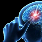 Más de seis millones de personas en el mundo tienen un aneurisma cerebral