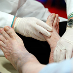 Denuncian en Argentina que un médico amputó a una mujer la pierna equivocada