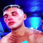 Fallece otro boxeador por lesiones recibidas en pelea