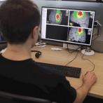 NVIDIA desarrolla una IA para analizar las pruebas médicas e identificar tumores cerebrales