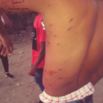 Varios heridos de perdigones en protesta de campesino en Monte Grande, Barahona