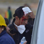 Las autopsias confirman nueve muertes por disparos en disturbios en Bolivia