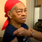 Mujer de 82 años envía al hospital a ladrón que intentó robar en su casa