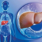 Hospital de Nueva Jersey admite que trasplantó hígado a paciente equivocado