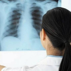 Un estudio asocia dormir demasiado o poco con mayor riesgo de fibrosis pulmonar