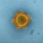 Alerta global por temor a que el virus llegue a países incapaces de pararlo