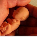 El aborto de un feto de siete meses reaviva el debate en Colombia