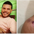 Dos heridos en enfrentamiento a tiros entre seguidores del PRM y PLD en Monte Cristi