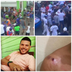 Elecciones municipales: Al menos siete lesionados en diferentes enfrentamientos por política