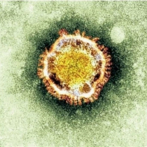 OPS enviará misión por coronavirus a países con 