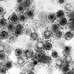 Descubren cómo el virus del herpes simple puede evadir la respuesta inmune para infectar el cerebro