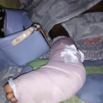 Familia solicita ayuda para intervención de pierna rota de niño en San Pedro de Macorís