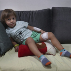 Los niños en Beirut sufren trauma tras la potente explosión