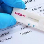 Unas 82,224 personas se han infectado de coronavirus en RD; 1,130 casos nuevos en un día