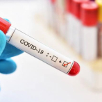 Reportan 425 casos nuevos de coronavirus; hay 157 pacientes en UCI y 75 con ventiladores
