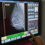 Una investigación internacional apunta a un nuevo tratamiento eficaz contra el cáncer de mama