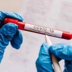 Otros 492 casos positivos de coronavirus y tres muertes registra Salud Pública