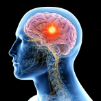 Los tumores cerebrales pueden surgir de una lesión no curada adecuadamente, debido a la inflamación