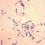 Salud Pública emite alerta epidemiológica por casos de difteria