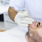 Las bacterias bucales son la principal causa de periodontitis, una de las principales causas de la pérdida de dientes