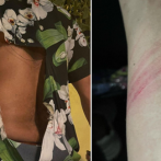 Fans de Wason Brazobán le rompen la camisa por una foto; el cantante dice 