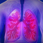 Hospitales presentan altos casos por afecciones respiratorias