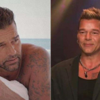 Ricky Martin asegura que no se ha hecho retoques faciales