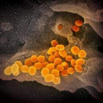 La variante ómicron alcanza el 28 % de los contagios registrados en Italia