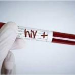 Exhortan a personas que padecen de VIH vacunarse contra el covid-19