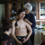 Mexicana Sashenka Gutiérrez, premiada por foto de cáncer de mama