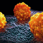 Un virus modificado genéticamente ayuda a combatir cáncer páncreas avanzado
