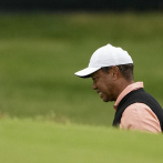 Tiger Woods se baja del US Open debido a dolores en la pierna
