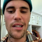Justin Bieber sufre parálisis facial