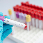 Un compuesto en el semen inhibe una variante del VIH