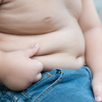 La obesidad infantil en Estados Unidos sigue creciendo y ya afecta al 21%