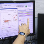 Costa Rica registra tres casos positivos de viruela del mono