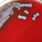 Hallan en Misisipi la bacteria de una enfermedad rara