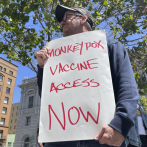 San Francisco declara emergencia por brote de viruela símica