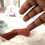 Familia de bebé prematuro pide ayuda para costear tratamiento