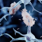 Identifican dos nuevos genes que aumentan el riesgo de desarrollar Alzheimer