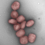 Estudio muestra la presencia del virus de la viruela del mono en el aire de pacientes infectados