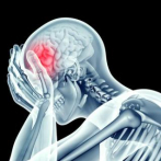 ¡Cuidado! Los dolores de cabeza también pueden ser provocados por problemas en los huesos