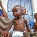 OMS alerta que alrededor del 45% de las muertes de menores de 5 años tienen que ver con desnutrición