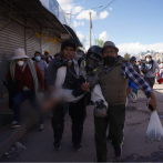 Disparan en la pierna a fotógrafo de la Agencia EFE mientras cubría protestas en Perú