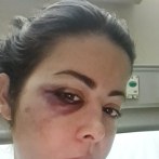 Dafne Guzmán fue sometida a cirugía en la cabeza tras sufrir caída de su cama, mientras dormía