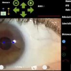 Utilizan un App en investigación sobre “ojos cruzados”