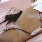 La FDA se mueve para facilitar las reglas para las donaciones de sangre de hombres homosexuales