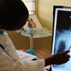 En 2022 fueron identificados 1, 896 casos de tuberculosis